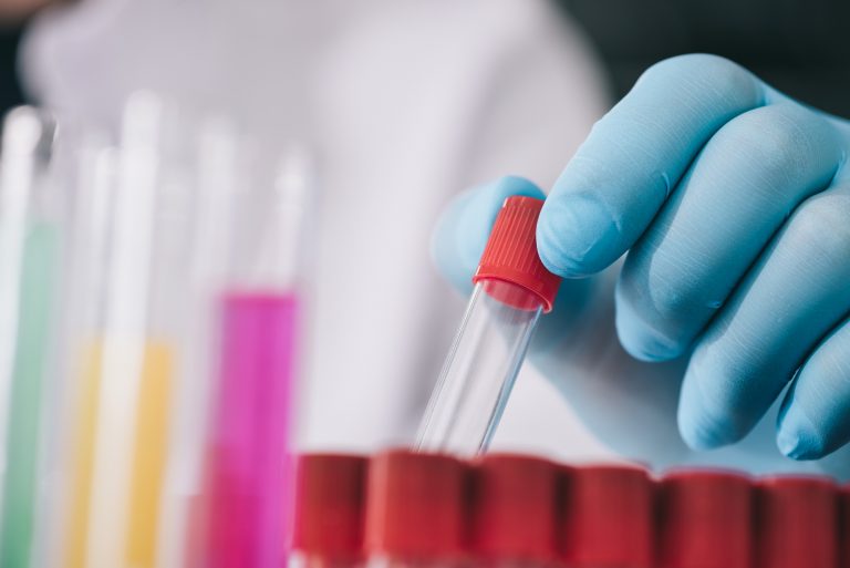 Investigațiile medicale vor fi decontate și după epuizarea plafonului, în anumite cazuri