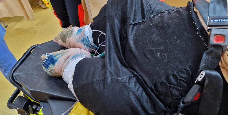 O femeie suferind de ”elefantiazis”, o boală extrem de rară, a fost adusă la Spitalul din Giurgiu, cu mari dificultăți, de pompierii  giurgiuveni